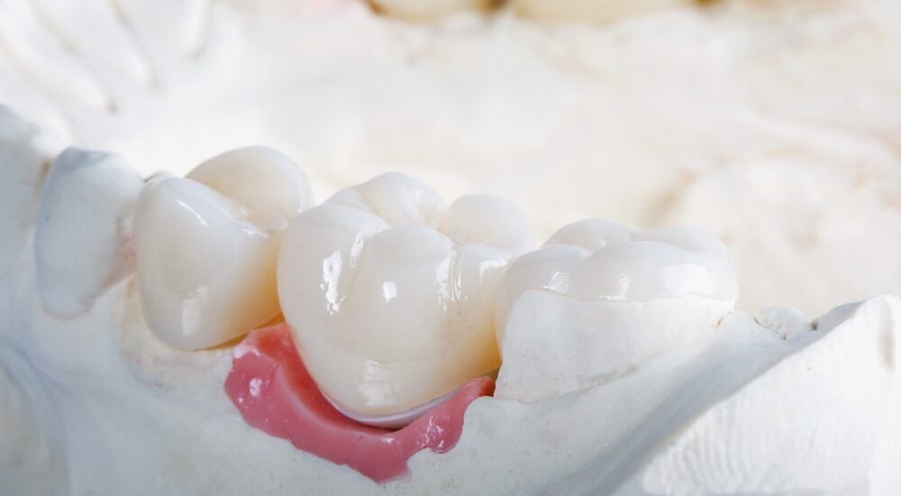 当院の審美歯科セラミック治療の特徴